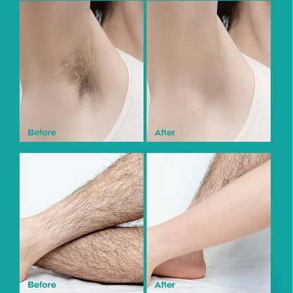 Painless Full Body Hair Removal Cream for Men & Women